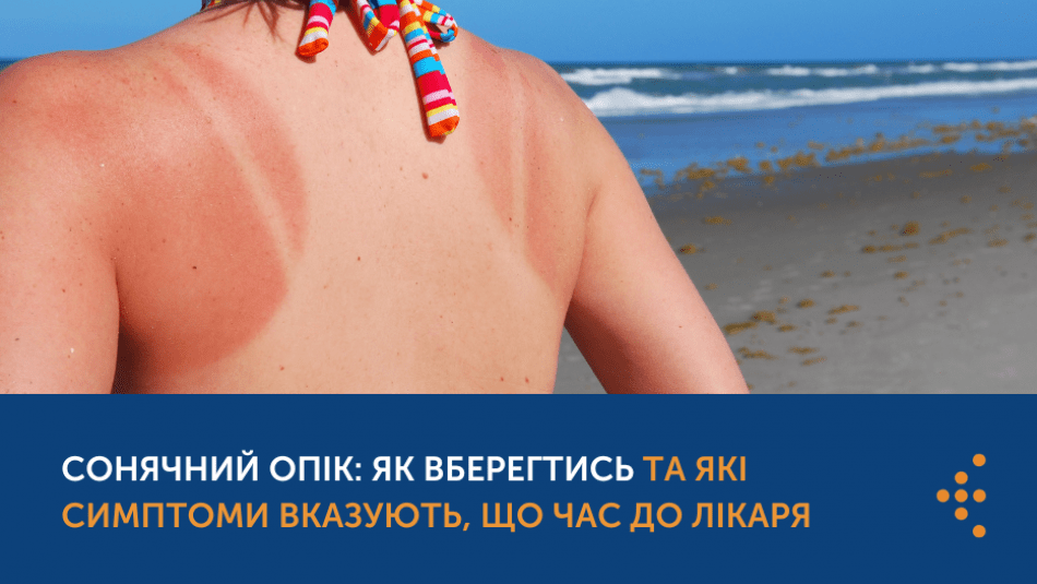 СОНЯЧНИЙ ОПІК: ЯК ВБЕРЕГТИСЬ ТА ЯКІ СИМПТОМИ ВКАЗУЮТЬ, ЩО ЧАС ДО ЛІКАРЯ